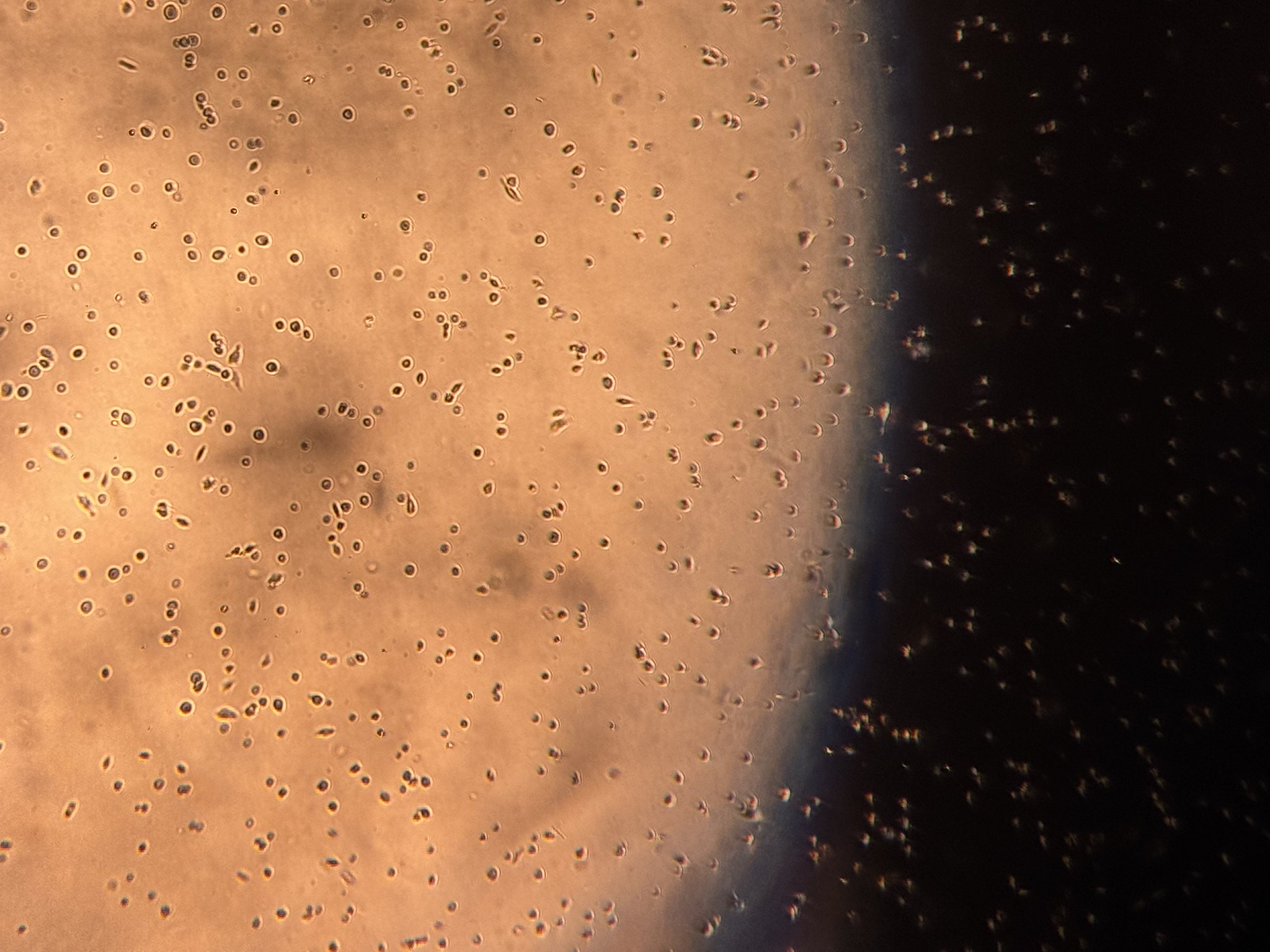 Close-up of orange orb under a microscope showing tiny nanoplastic fragments over a black background
